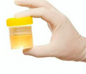 urina maleodorante