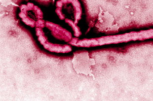 ebola ematemesi
